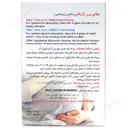 مولتی پرن آرایکس